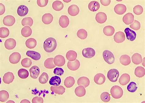  Babesia! En mikroskopisk parasit som lever ett liv fullt av oväntade värdbyten