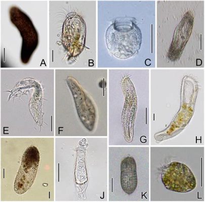  Strombidium! En mystisk mikroorganismen som simmar med hjälp av små hårartade strukturer och skapar komplexa cirkulära rörelsemönster